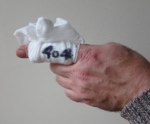 bandaged finger with 404 written on bandage